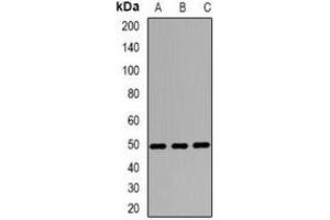 Western blot analysis of Wilms Tumor 1 expression in A549 (A), MCF7 (B), mouse heart (C) whole cell lysates. (WT1 antibody)