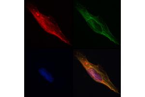 ABIN6261605 and ABIN6268755 staining Hela by IF/ICC. (EpCAM antibody  (Internal Region))
