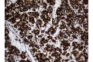 Image no. 3 for anti-NADH Dehydrogenase (Ubiquinone) 1 beta Subcomplex, 10, 22kDa (NDUFB10) antibody (ABIN1499672) (NDUFB10 antibody)