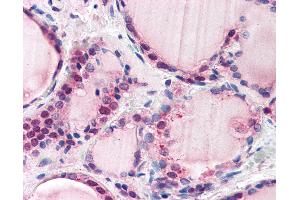 Anti-FBXL3 antibody IHC of human thyroid. (FBXL3 antibody  (AA 2-15))