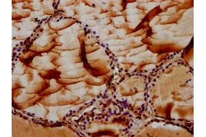 IHC image of ABIN7151913 diluted at 1:100 and staining in paraffin-embedded human thyroid tissue performed on a Leica BondTM system. (MAN2B2 antibody  (AA 347-523))
