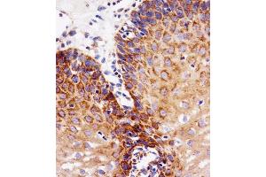 Immunohistochemistry (Paraffin-embedded Sections) (IHC (p)) image for anti-Epidermal Growth Factor Receptor (EGFR) (AA 1163-1191), (C-Term) antibody (ABIN1882237)