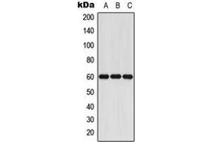 Western blot analysis of Cytochrome P450 11A1 expression in Jurkat (A), mouse liver (B), rat liver (C) whole cell lysates. (CYP11A1 antibody  (C-Term))
