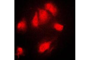 Immunofluorescence (IF) image for anti-Nuclear Factor of kappa Light Polypeptide Gene Enhancer in B-Cells Inhibitor, alpha (NFKBIA) (N-Term), (pSer32), (pSer36) antibody (ABIN7296422)