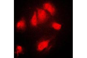 Immunofluorescent analysis of IKB alpha (pS32/S36) staining in Raw264. (NFKBIA antibody  (N-Term, pSer32, pSer36))