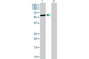 Western Blot analysis of CDKL3 expression in transfected 293T cell line by CDKL3 MaxPab polyclonal antibody. (CDKL3 antibody  (AA 1-592))