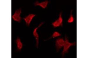 ABIN6275961 staining COLO205 by IF/ICC. (GPR160 antibody  (C-Term))