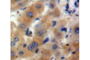 Used in DAB staining on fromalin fixed paraffin-embedded Liver tissue (ARTN antibody  (AA 112-224))