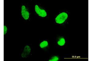 Immunofluorescence (IF) image for anti-Histone Deacetylase 4 (HDAC4) (AA 551-648) antibody (ABIN523212)