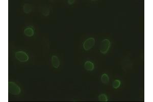 Anti-SOX17 mouse monoclonal antibody (ABIN2452368) immunofluorescent staining of HeLa cells transiently transfected by pCMV6-ENTRY SOX17 (RC220888) (SOX17 antibody  (AA 177-414))
