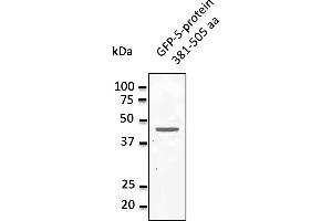Western Blotting (WB) image for anti-MERS-Coronavirus Spike Protein (MERS-CoV S) (AA 381-505) antibody (ABIN6254147)