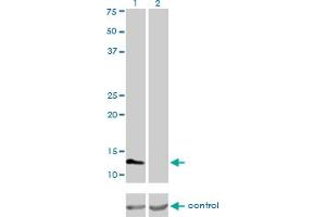Western blot analysis of FABP3 over-expressed 293 cell line, cotransfected with FABP3 Validated Chimera RNAi (Lane 2) or non-transfected control (Lane 1).