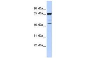 Image no. 1 for anti-Sex Comb On Midleg-Like 4 (SCML4) (AA 72-121) antibody (ABIN6740386) (SCML4 antibody  (AA 72-121))