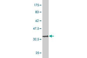 Western Blot detection against Immunogen (36. (TFDP3 antibody  (AA 1-100))
