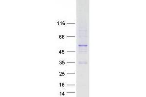Western Blotting (WB) image for Paired Box Gene 2a (PAX2A) (Transcript Variant A) protein (Myc-DYKDDDDK Tag) (ABIN2728308)