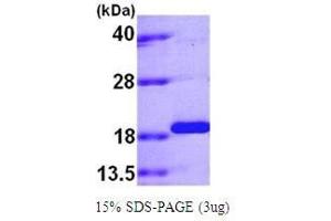 Figure annotation denotes ug of protein loaded and % gel used. (PPIL1 Protein (AA 1-166) (His tag))