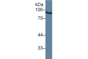 Detection of ANG in Mouse Liver lysate using Polyclonal Antibody to Angiostatin (ANG) (Angiostatin antibody  (AA 79-466))