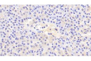Immunohistochemistry (IHC) image for anti-Iron-Responsive Element Binding Protein 2 (IREB2) (AA 39-281) antibody (ABIN7441505)