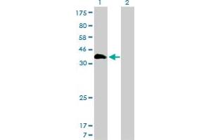 Western Blot analysis of HOXA11 expression in transfected 293T cell line by HOXA11 monoclonal antibody (M01), clone 7E12. (Homeobox A11 antibody  (AA 60-166))