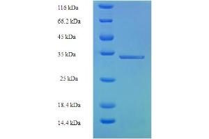 SDS-PAGE (SDS) image for Ubiquitin D (UBD) (AA 1-165), (full length) protein (His-SUMO Tag) (ABIN4975656)