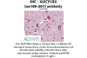 Image no. 2 for anti-Guanylate Cyclase 1, Soluble, beta 3 (GUCY1B3) (AA 189-207) antibody (ABIN2852385) (GUCY1B3 antibody  (AA 189-207))