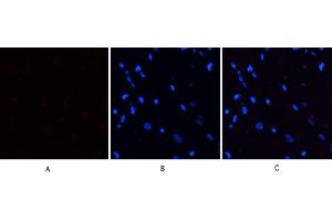 Immunofluorescence analysis of rat heart tissue. (PERK antibody  (pThr981))