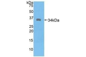 Detection of Recombinant DMD, Human using Polyclonal Antibody to Dystrophin (DMD)