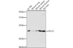 Western blot analysis of extracts of various cell lines, using SOCS1 antibody (ABIN6128737, ABIN6148263, ABIN6148266 and ABIN6223700) at 1:1000 dilution. (SOCS1 antibody  (AA 1-211))