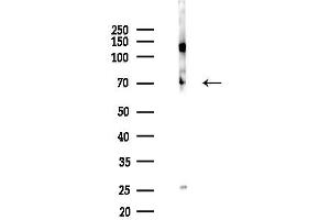 Western blot analysis of lysates from Rat testis, using SDHA Antibody at 1/1000 dilution.