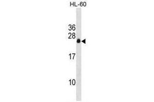 APRG1 Antibody (Center) western blot analysis in HL-60 cell line lysates (35µg/lane). (C3ORF35 antibody  (Middle Region))