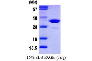 SDS-PAGE (SDS) image for Cyclin-Dependent Kinase 2 (CDK2) (AA 1-298) protein (His tag) (ABIN667950)