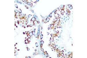 Immunohistochemistry (IHC) image for anti-Stress-Induced-phosphoprotein 1 (STIP1) (AA 1-300) antibody (ABIN6148592)