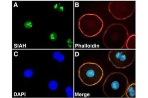 Immunofluorescence staining of SIAH2 on NIH : OVCAR-3 with SIAH2 monoclonal antibody, clone 24E6H3 . (SIAH2 antibody  (AA 1-100))