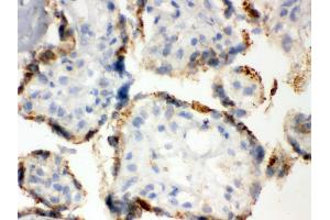 Immunohistochemistry (IHC) image for anti-Protein Disulfide Isomerase Family A, Member 3 (PDIA3) (AA 471-505), (C-Term) antibody (ABIN3043898)