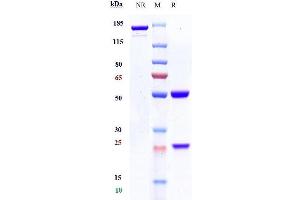 Anti-CD19 Reference Antibody (tafasitamab) on SDS-PAGE under reducing (R) condition. (Recombinant CD19 (Tafasitamab Biosimilar) antibody)