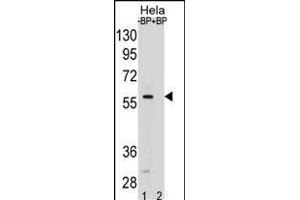 SD5 Antibody (Center) (ABIN1881816 and ABIN2838794) pre-incubated without(lane 1) and with(lane 2) blocking peptide in Hela cell line lysate. (SMAD5 antibody  (AA 241-269))