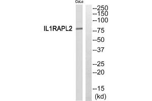 Western blot analysis of extracts from COLO205 cells, using IL1RAPL2 antibody. (IL1RAPL2 antibody  (Internal Region))