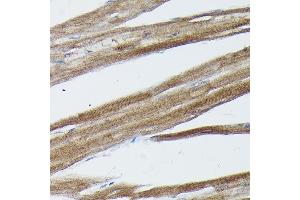 Immunohistochemistry (IHC) image for anti-Suppressor of Cytokine Signaling 3 (SOCS3) (C-Term) antibody (ABIN3021100)