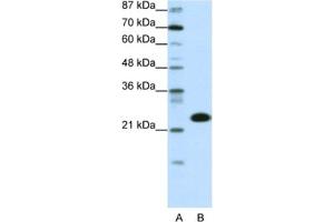 Western Blotting (WB) image for anti-TATA Box Binding Protein Associated Factor 11 (TAF11) antibody (ABIN2460381) (TAF11 antibody)