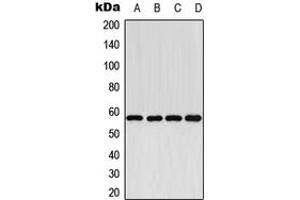 Western blot analysis of Cytochrome P450 2E1 expression in HEK293T (A), NIH3T3 (B), H9C2 (C), Human Liver (D) whole cell lysates. (CYP2E1 antibody  (C-Term))