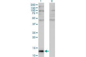 Western Blot analysis of ANG expression in transfected 293T cell line by ANG monoclonal antibody (M05), clone 2A7.