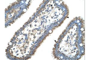 CPS1 antibody was used for immunohistochemistry at a concentration of 4-8 ug/ml. (CPS1 antibody  (N-Term))