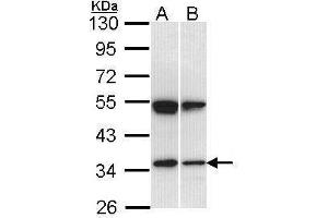 WB Image Sample (30 ug of whole cell lysate) A: Hep G2 , B: Raji 10% SDS PAGE antibody diluted at 1:1000 (SH3GL1 antibody  (Center))