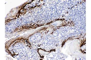 IHC analysis of FDCSP using anti- FDCSP antibody .