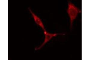 ABIN6275782 staining Hela cells by IF/ICC. (MYL6 antibody  (Internal Region))