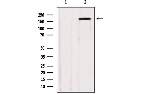 ZCCHC11 antibody  (Internal Region)