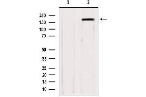 Western blot analysis of extracts from various samples, using ZCCHC11 antibody. (ZCCHC11 antibody  (Internal Region))