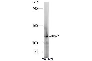 Mouse liver lysates probed with Rabbit Anti-DIM 7 Polyclonal Antibody, Unconjugated (ABIN2173613) at 1:300 overnight at 4˚C. (Moleskin antibody  (AA 401-500))