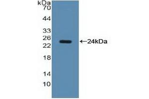 Detection of Recombinant NCL, Human using Polyclonal Antibody to Nucleolin (NCL) (Nucleolin antibody  (AA 388-569))