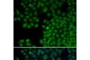 Immunofluorescence analysis of HeLa cells using NUDT6 Polyclonal Antibody (NUDT6 antibody)